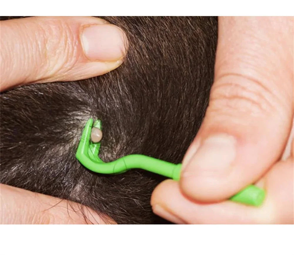 Tick & Flea Remover Tool Set